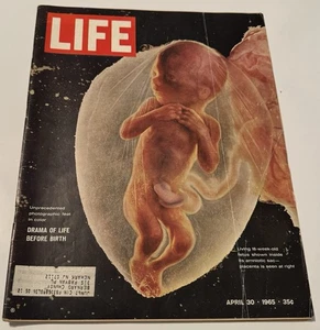 Life Magazine, April 30 1965, Drama Of Life, Fair Condition - Imagen 1 de 7