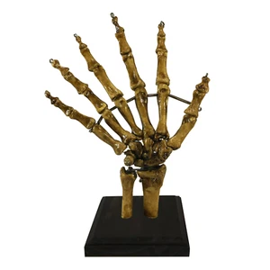 Alter BIZARR! 6 Finger Medizinisches Exemplar Skelett Hand Kuriosität Gaff - Bild 1 von 6
