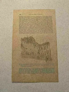 KP200) Granulazione Dolore Iniettato Arteria Piccola Vena Medica 102 1878 Incisione - Foto 1 di 1