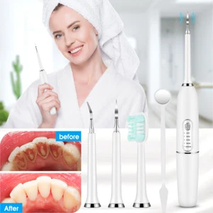 Electric Tooth Cleaner Ultrasonic Dental Scaler Tartar Plaque Calculus Remover - Picture 1 of 15