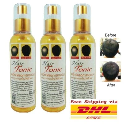 3 GENIVE HAIR TONIC REDUCE HAIR LOSS CREATE HAIR REPLACEMENT ANTI DANDRUFF 120ml - Image 1 of 4