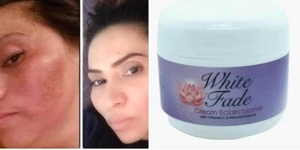 White Fade Creams; Para Eliminar Manchas Oscuras De La Piel, 2oz por unidad - Picture 1 of 9