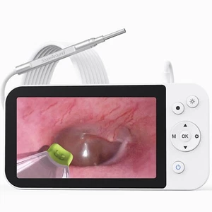 3.9mm Otoscope Camera Ear Wax Removal inspection camera 1080P HD Video Endoscope - Picture 1 of 12