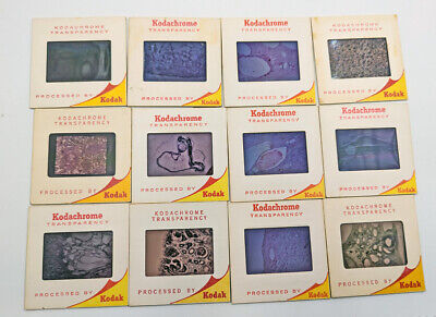 Lot of 12 Medical Specimen Cell Slides Kodak ...