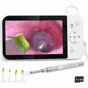 NEW Ear Wax Remover Camera 1080P Ear Endoscope Cleaner Otoscope with 5''Screen - Picture 1 of 10
