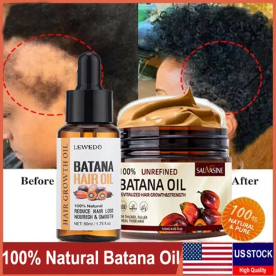 Natural Batana Oil Serum for Hair Growth Healthier,Thicker Repair Damaged Hair - Image 1 of 4