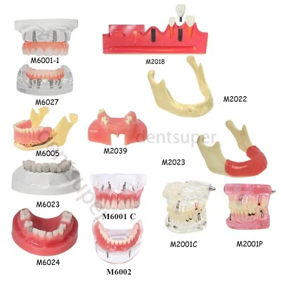 Демонстрационная модель зубов для обучения имплантатам нескольких типов Typodont Ortho - Изображение 1 из 4