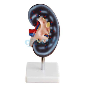 2X Life Size human Right kidney Anatomical Medical Model On the Base - Picture 1 of 4