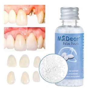 Cuentas de reparación dental gránulos pegamento dental temporal reutilizable moldeable dientes postizos - Imagen 1 de 21