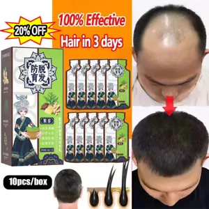Ginger Plant Extract Anti-Hair Loss Hair Shampoo For Oil Control Hair Growth US - Picture 1 of 15