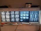 CT Scans X-RAY FILM - Material For Radiologist, Chiropractors, And Pathology