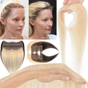 Full Lace Cover Up Receding Hairline Topper Remy Human Hair Loss Patch One Piece - Picture 1 of 19