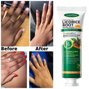 Crema mani sbiancante rapido nocche scure illuminante correttore melanina idratante - Foto 1 di 7