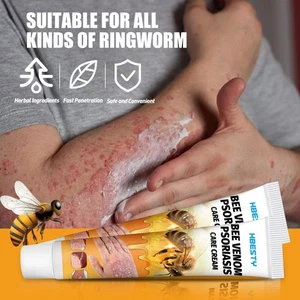 20G Bee Venom Psoriasis Cream Skin Treatment Scalp Hand Foot Mild Formula - Picture 1 of 11