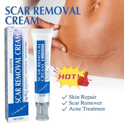 SCAR REMOVAL CREAM Skin Repair Scar Remover丨Fade Stretch Mark丨Acne Treatment 1 x - Image 1 of 4
