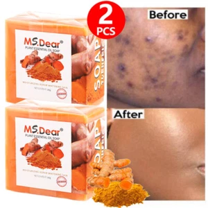 2X Turmeric Soap Bar for Face & Body-Tumeric Soap,Acne, Dark Spots, Smooth Skin - Picture 1 of 19