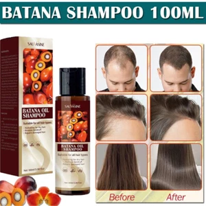Hair Growth Shampoo Batana Oil Repairing Nourishing Natural Shampoo Hair Care - Picture 1 of 12