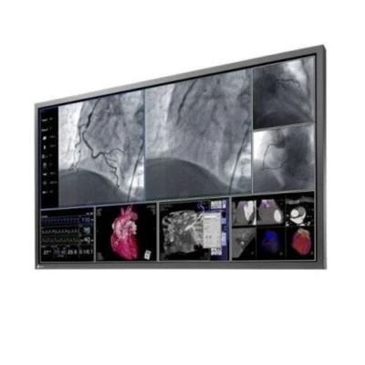 Eizo Radiforce LS580W Cath Lab MONITOR   6GF6200-8AB01 58"   58-inch LCD - Image 1 of 4