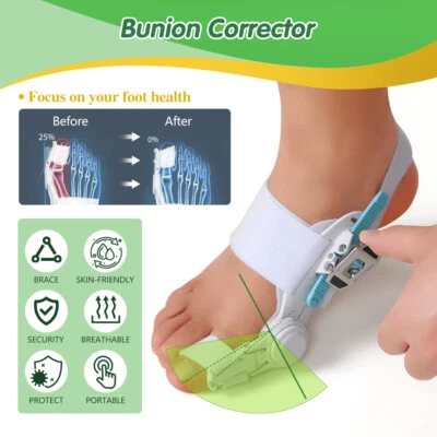 Bunion Corrector Big Toe Straightener Bunion Splints Correction for Women & Men - Image 1 of 4