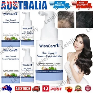 1-4Pcs WishCare Hair Growth Concentrate WishCare Serum for Hairfall Reduce 30ML - Picture 1 of 13
