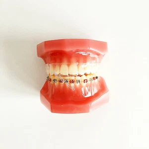Dental Ortho Teeth Treatment Model Invisible Metal Alignment Trainer Retainer - Picture 1 of 8