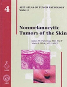 Nonmelanocytic Tumors of the Skin by James W. Patterson (English) Hardcover Book - Picture 1 of 1