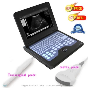 Laptop Portable Ultrasound scanner machine,6.5Mhz transvaginal,3.5M convex probe - Picture 1 of 12