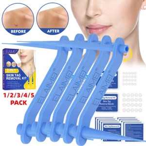 Kit de dispositivo removedor de etiquetas micro piel EE. UU. Herramienta de banda de 2-7 mm para eliminación segura sin dolor - Imagen 1 de 16