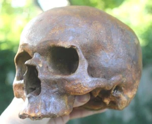 Human Skull Anatomical Medical Death Oddity Theater Funeral Postmortem Doctors - Picture 1 of 6