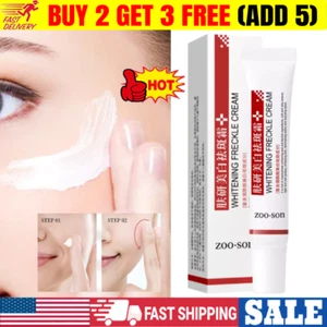 Face Roller Skin Care New Spots Off Freckle Whitening Creams Effective Whitening - Picture 1 of 10