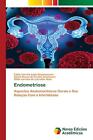 Endometriose By Fabio Correia Lima Nepomuceno (Portuguese) Paperback Book