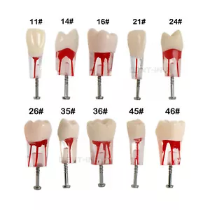 10Pcs Dental Endo Root Canal Teeth Typodont Model Study Practice #8006 RCT - Picture 1 of 79