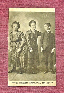SIAMESE TWINS ROSA & JOSEPHA BLAZEK & SON FREAK CIRCUS SIDESHOW PERFORMER - Picture 1 of 2