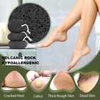 Natural Black VOLCANIC LAVA PUMICE Foot Stone Scrub Dead Skin Callus CrackedHeel