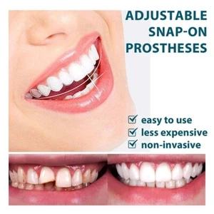 Snap On False Teeth Upper + Lower Dental Veneers Dentures Tooth Cover Set Hot - Picture 1 of 8