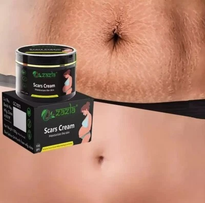 Best Scar Removal-Cream for Old-Scars Stretch Mark Removal Cream UNISEX 100g - Image 1 of 4