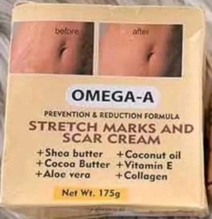 Stretch Marks and Scars Cream Omega - A 175g free post  - Image 1 of 1