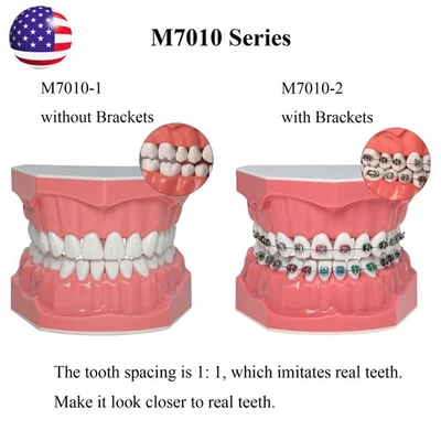Dental Typodont Orthodontic Teeth Model with Metal Braces for Brushing Practice - Image 1 of 4