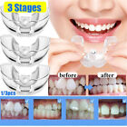 Erwachsene Zahnspange Retainer Kieferorthopadische Zahnkorrektur Dental Brace