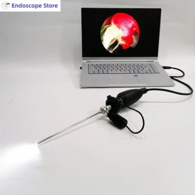 HD 1080P USB Endoscope Camera With LED Light Source ENT  Examination Veterinary - Image 1 of 4