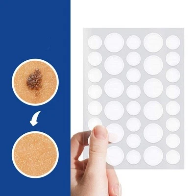 SKIN TAG REMOVER PATCHES NATURAL TREATMENT MOLES WARTS SAFE NO PAIN/SCARS 32-72