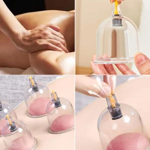 Vacuum Cupping Cup Acupuncture Suction Massage Cupping Can  - Bild 1 von 16