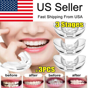 3 Stages Dental Orthodontic Teeth Corrector Braces Tooth Retainer Straighten USA