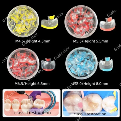GOLDENKEY Dental Clear Matrix Posterior Transparent BT Matrices Fits Bioclear 4.5/5.5/6.5