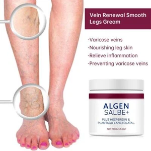 1PCS 100g Varicose Vein Cream For Legs Eliminate Varicose Care BEST Veins G8G8 - Picture 1 of 12