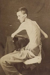 FOTO de prisionero de la Unión de 1864 soldado de la Guerra Civil de la prisión confederada de Belle Isle - Imagen 1 de 1