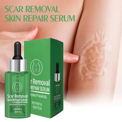 Skin Care Body Serum Lotion Postpartum Belly Care Skin Smoothing Skin Oil Serum - image 1 of 4