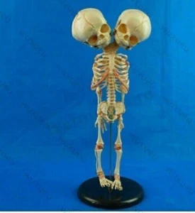 Baby Skelett mit Doppelkopf Modell Anatomie Lehrmodell Medizinische Neu DE - Bild 1 von 2