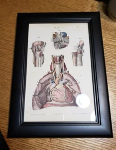 Systeme Nerveux 1866 full framed colored print - amazing detail French book - Picture 1 of 2