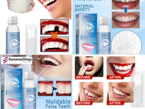 🦷 Resin Dentures Temporary False Teeth Solid Glue Temporary Tooth Repair Mold🦷 - Picture 1 of 7